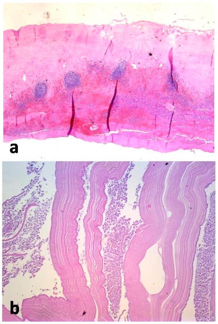 https://cdn.ncbi.nlm.nih.gov/pmc/blobs/7671/6956320/8a7bebc7a052/medicina-55-00771-g006.jpg