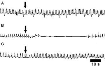 https://cdn.ncbi.nlm.nih.gov/pmc/blobs/7673/3016957/40aeed2450ab/f02_01.jpg