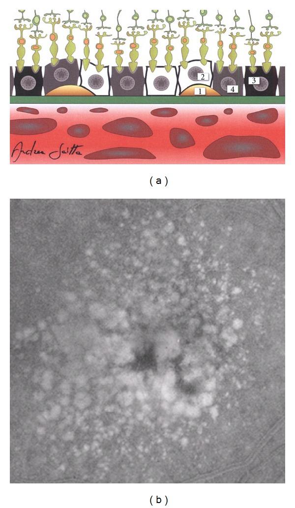 https://cdn.ncbi.nlm.nih.gov/pmc/blobs/7675/3504473/7e6916e0ebb3/MI2012-546786.003.jpg
