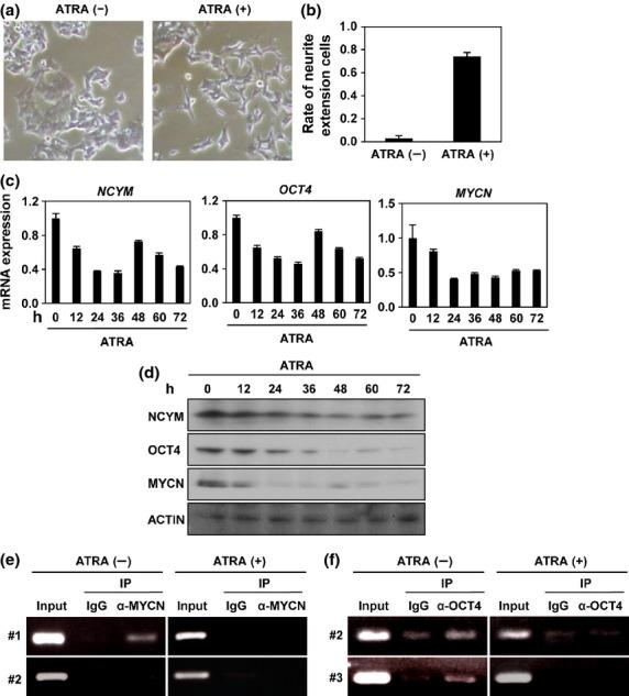 https://cdn.ncbi.nlm.nih.gov/pmc/blobs/7677/4520635/a442da69ec35/cas0106-0840-f4.jpg