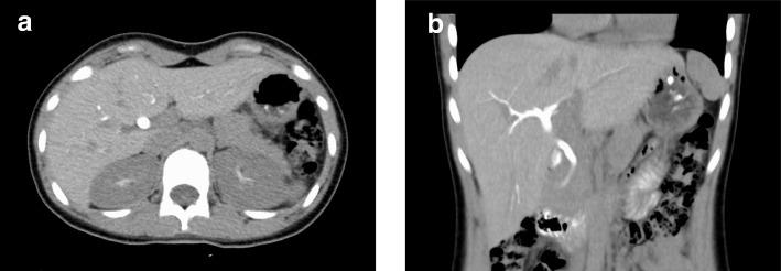 https://cdn.ncbi.nlm.nih.gov/pmc/blobs/7679/6241070/6138370ad758/12887_2018_1343_Fig2_HTML.jpg