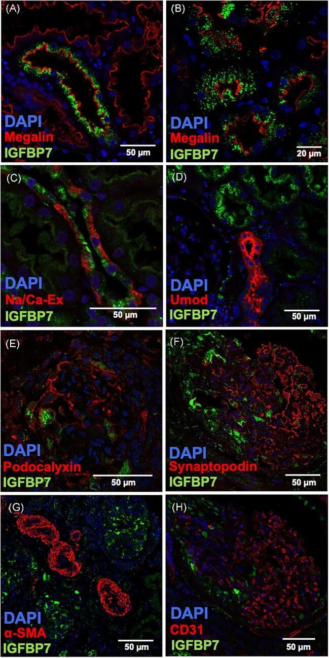 https://cdn.ncbi.nlm.nih.gov/pmc/blobs/7689/10468751/f444f67a524d/sfad010fig4.jpg