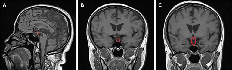 https://cdn.ncbi.nlm.nih.gov/pmc/blobs/768b/11235527/eb5e305513fb/WJCC-12-4348-g001.jpg