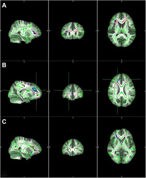 https://cdn.ncbi.nlm.nih.gov/pmc/blobs/768e/4735096/6f5b92f138f7/10194_2016_593_Fig3_HTML.jpg