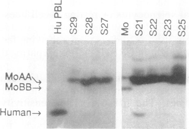 https://cdn.ncbi.nlm.nih.gov/pmc/blobs/768e/48378/5ccf760f691a/pnas01077-0244-b.jpg