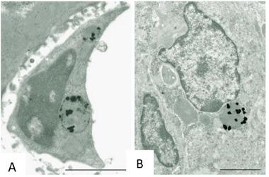 https://cdn.ncbi.nlm.nih.gov/pmc/blobs/7691/12023827/13a1208d7707/ADHM-14-0-g008.jpg
