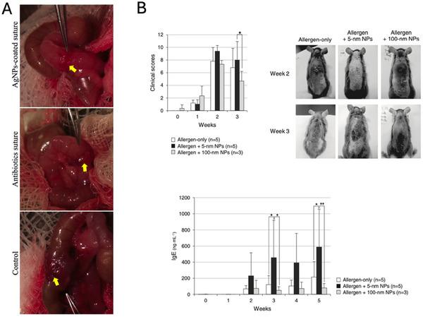 https://cdn.ncbi.nlm.nih.gov/pmc/blobs/7691/12023827/a015fab7750f/ADHM-14-0-g012.jpg