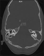 https://cdn.ncbi.nlm.nih.gov/pmc/blobs/7698/7586635/d9c73e1b7c41/JFMPC-9-4067-g005.jpg