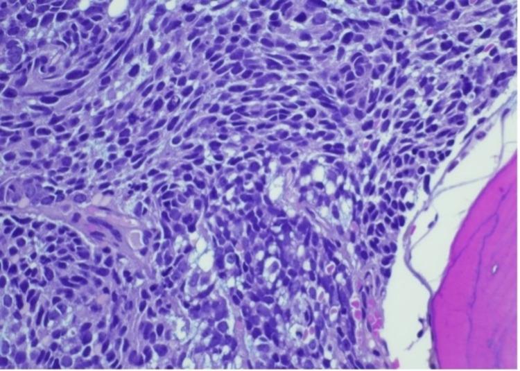 https://cdn.ncbi.nlm.nih.gov/pmc/blobs/769e/9135308/d9ab917a00b8/cureus-0014-00000024505-i03.jpg