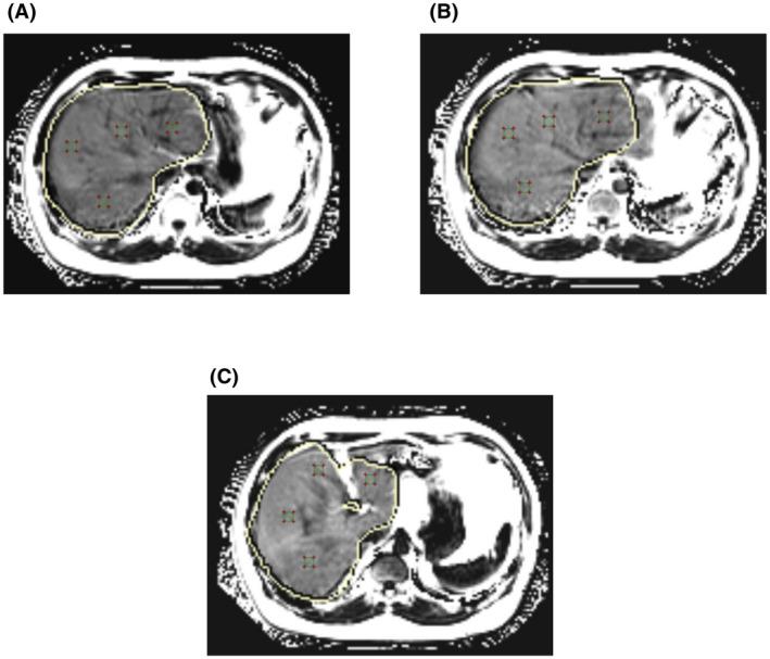 https://cdn.ncbi.nlm.nih.gov/pmc/blobs/76a6/9315137/adc137644b24/HEP4-6-1975-g001.jpg