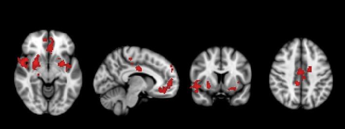 https://cdn.ncbi.nlm.nih.gov/pmc/blobs/76a9/6004402/fff55b3e20ca/fnhum-12-00222-g0002.jpg