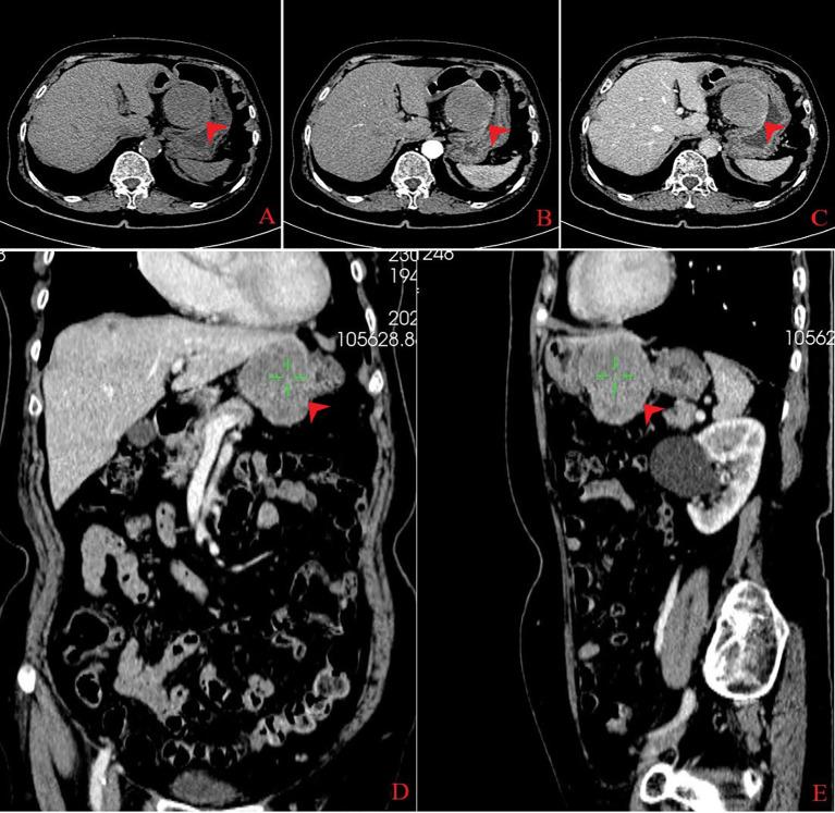 https://cdn.ncbi.nlm.nih.gov/pmc/blobs/76b3/11769998/5fa505f5c94d/fonc-14-1496074-g001.jpg