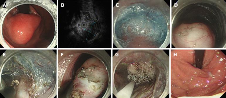 https://cdn.ncbi.nlm.nih.gov/pmc/blobs/76b3/12188769/0149b1270722/wjg-31-23-106261-g002.jpg