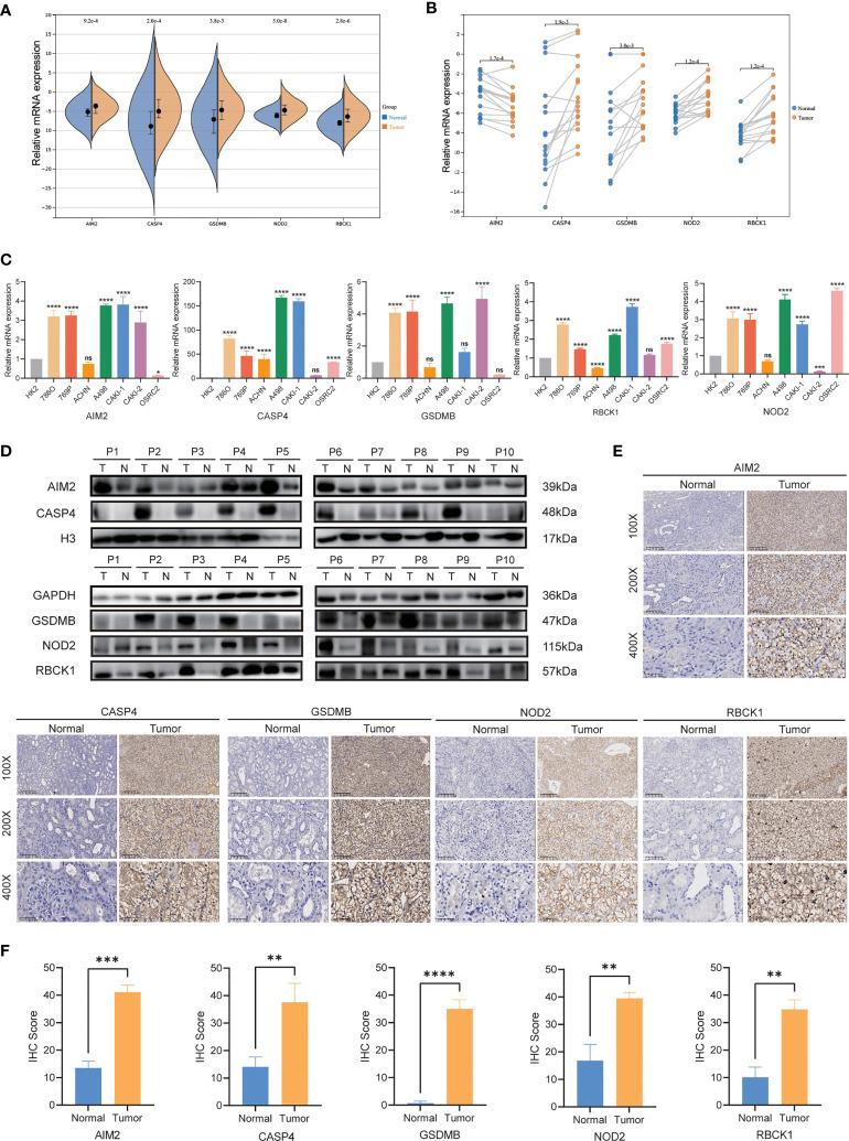 https://cdn.ncbi.nlm.nih.gov/pmc/blobs/76b3/9561249/4f657827f429/fimmu-13-1021935-g009.jpg