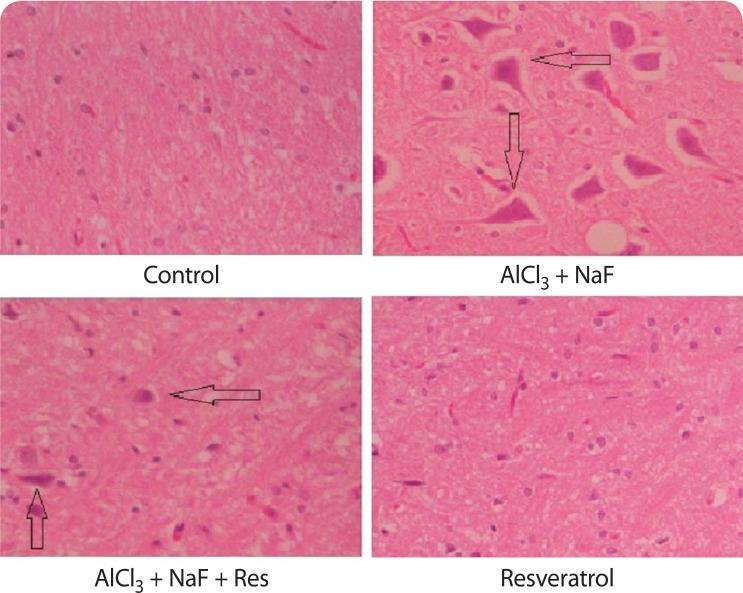 https://cdn.ncbi.nlm.nih.gov/pmc/blobs/76b5/5458107/7fb50bcc00c4/ITX-9-78-g004.jpg