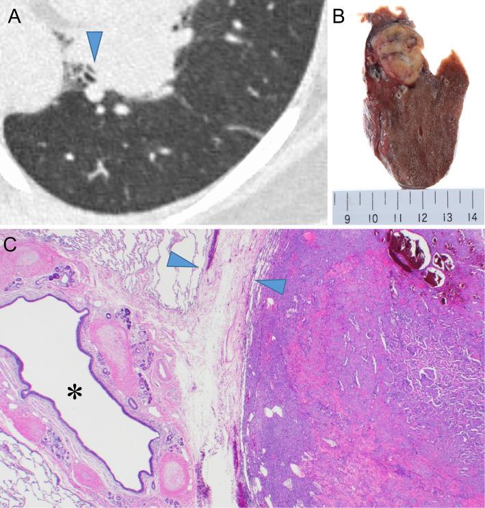 https://cdn.ncbi.nlm.nih.gov/pmc/blobs/76bf/11986300/9645c0100825/1349-7235-64-0893-g002.jpg