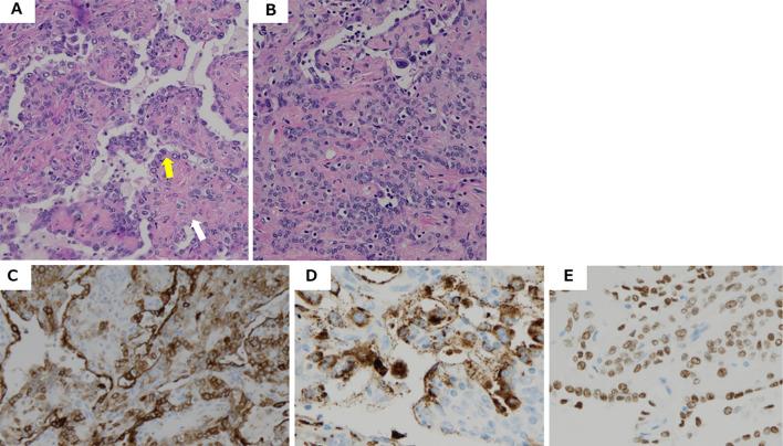 https://cdn.ncbi.nlm.nih.gov/pmc/blobs/76bf/11986300/e408353492a5/1349-7235-64-0893-g003.jpg