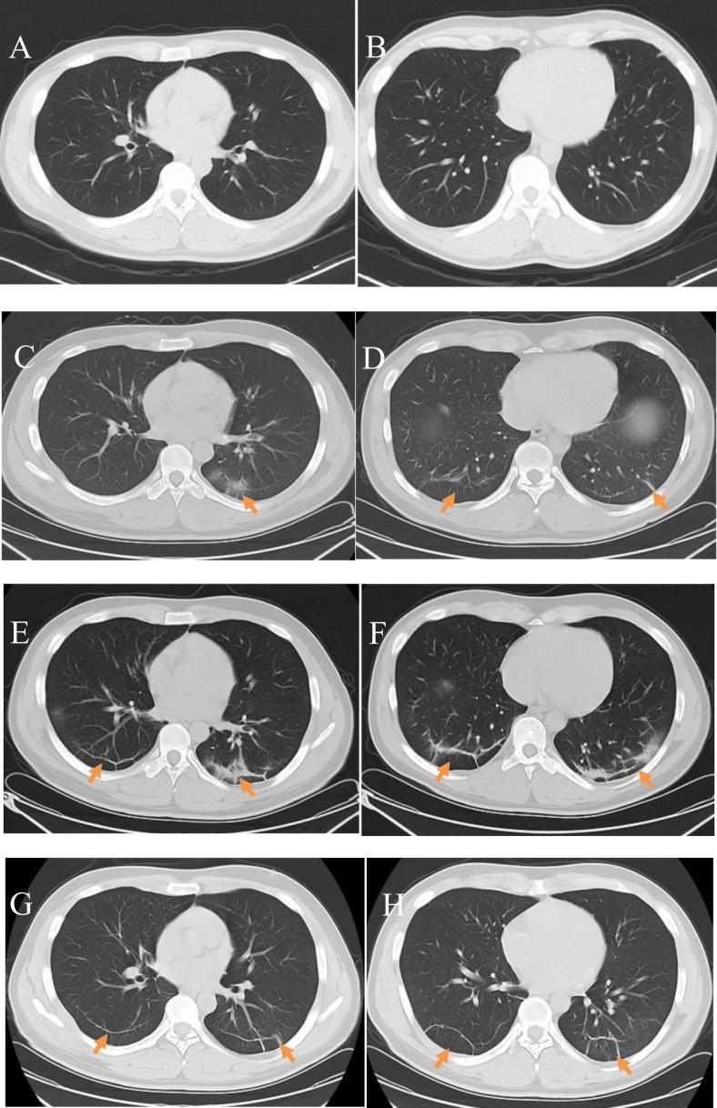 https://cdn.ncbi.nlm.nih.gov/pmc/blobs/76c5/7214302/1108a66bef12/gr6_lrg.jpg
