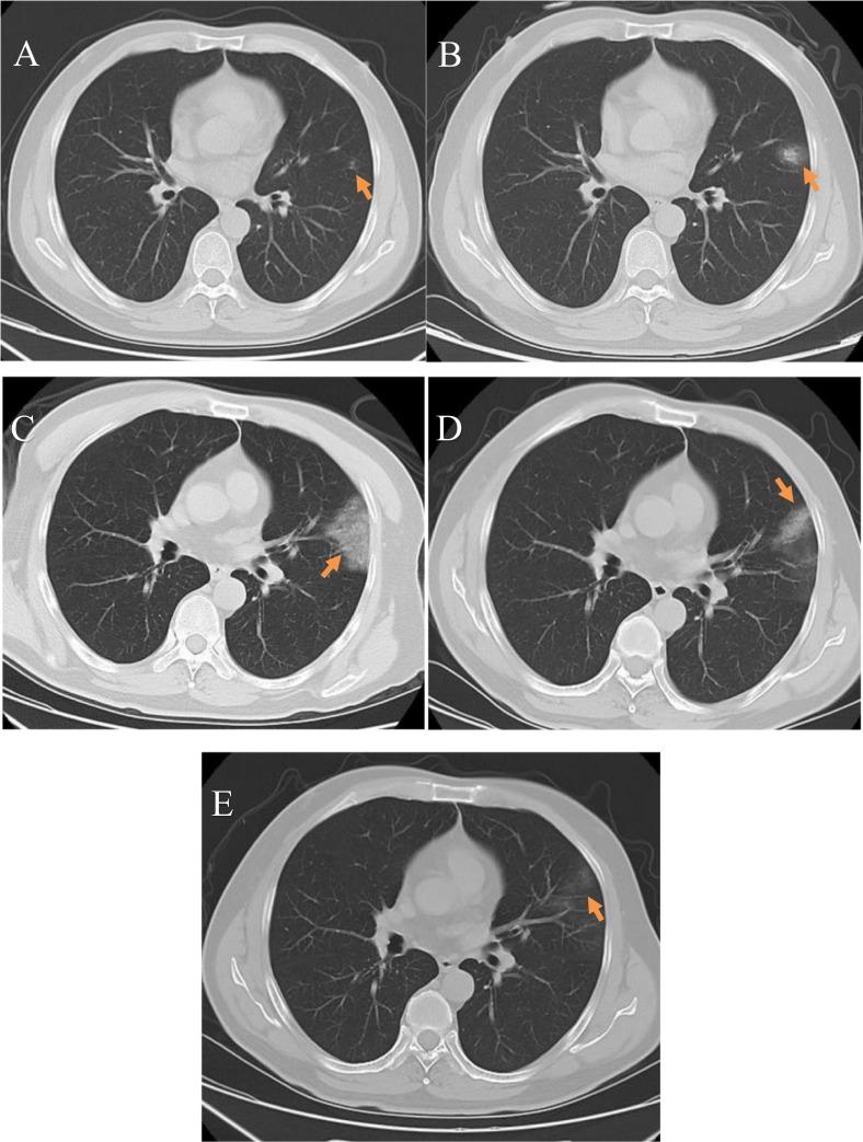 https://cdn.ncbi.nlm.nih.gov/pmc/blobs/76c5/7214302/e972f9d88646/gr1_lrg.jpg