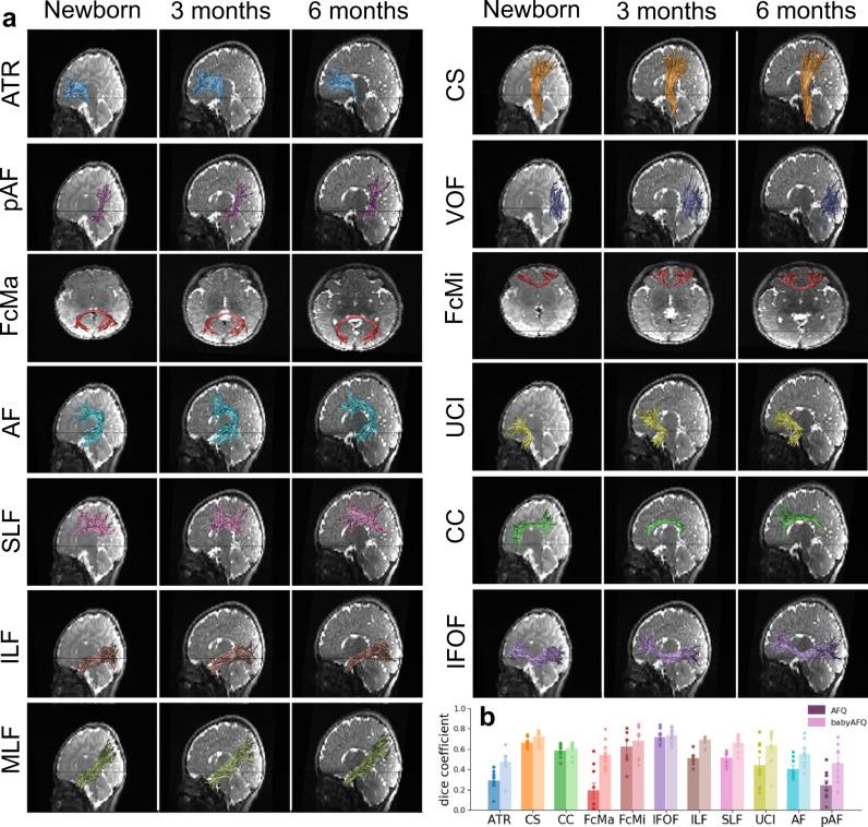 https://cdn.ncbi.nlm.nih.gov/pmc/blobs/76d2/8863985/32e1abd37530/41467_2022_28326_Fig1_HTML.jpg