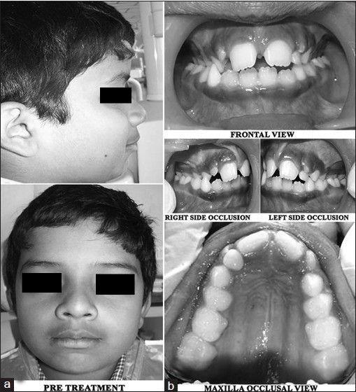https://cdn.ncbi.nlm.nih.gov/pmc/blobs/76d3/3883337/4e2bffcf22a0/CCD-4-523-g001.jpg