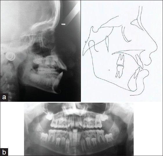 https://cdn.ncbi.nlm.nih.gov/pmc/blobs/76d3/3883337/cb94781b7a3b/CCD-4-523-g002.jpg