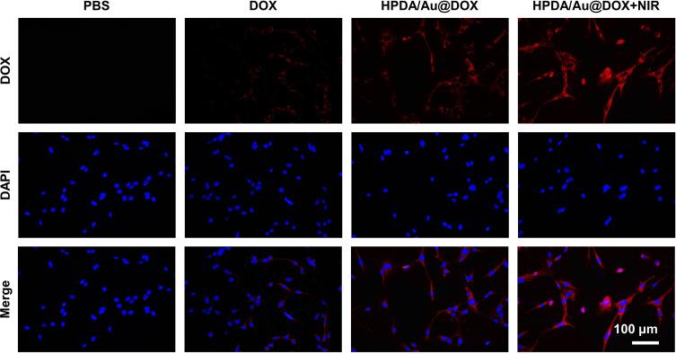 https://cdn.ncbi.nlm.nih.gov/pmc/blobs/76d7/11409934/9446aa84276d/IJN-19-9597-g0005.jpg