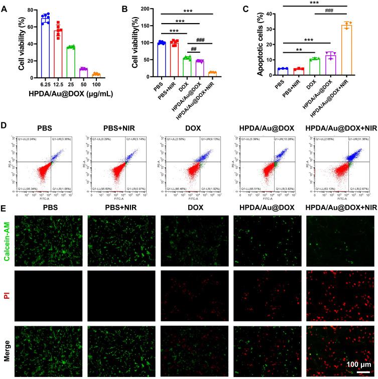 https://cdn.ncbi.nlm.nih.gov/pmc/blobs/76d7/11409934/d1490a272f88/IJN-19-9597-g0004.jpg