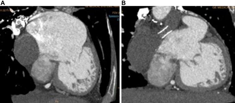 https://cdn.ncbi.nlm.nih.gov/pmc/blobs/76db/12245474/638a2842ae24/gr4.jpg