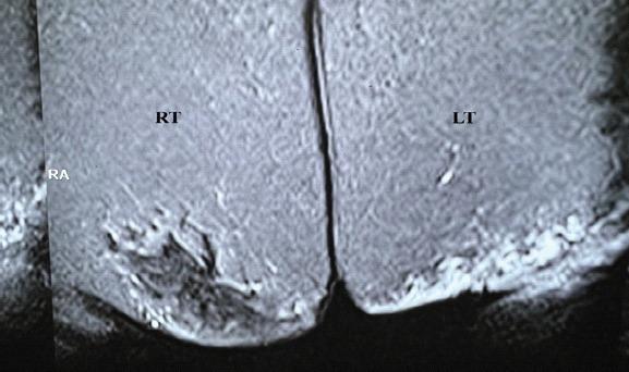 https://cdn.ncbi.nlm.nih.gov/pmc/blobs/76e7/10092383/95f9e93472f6/JOCR-12-78-g002.jpg