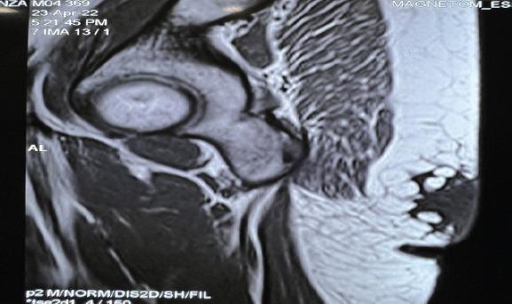 https://cdn.ncbi.nlm.nih.gov/pmc/blobs/76e7/10092383/9caa80f91879/JOCR-12-78-g003.jpg