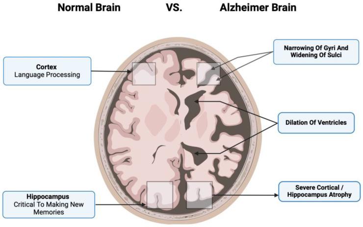 https://cdn.ncbi.nlm.nih.gov/pmc/blobs/76e7/11428860/b8a2766bcdc4/biomedicines-12-02113-g002.jpg