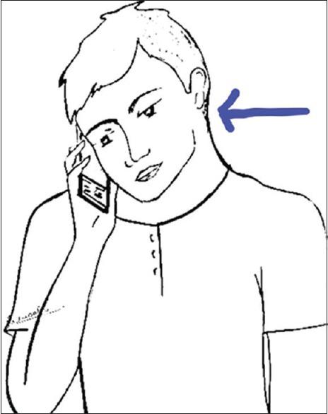 https://cdn.ncbi.nlm.nih.gov/pmc/blobs/76f4/6460974/d4fa2afe16b5/IJA-63-300-g002.jpg
