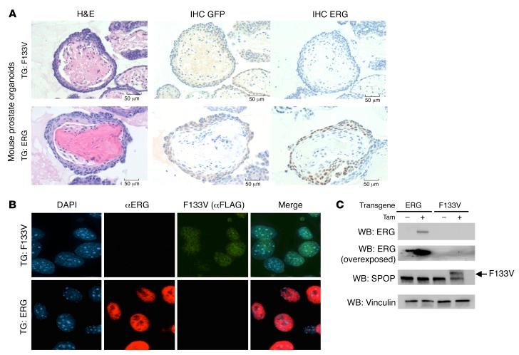 https://cdn.ncbi.nlm.nih.gov/pmc/blobs/76f8/5749531/264353553009/jci-128-96551-g002.jpg