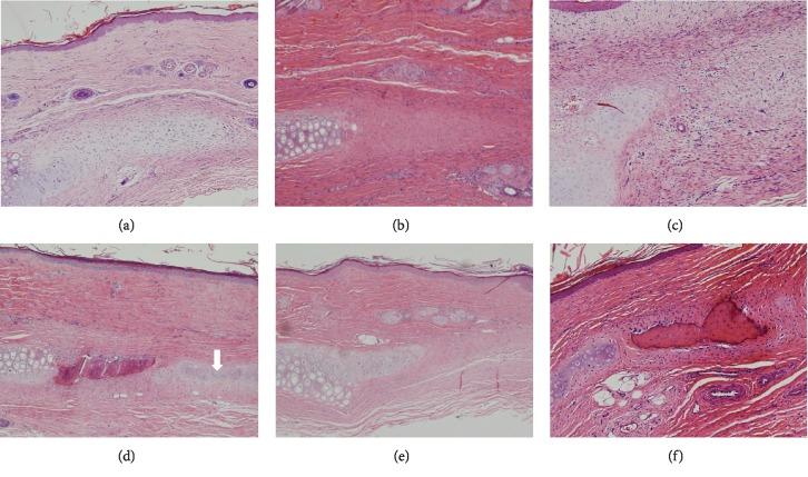 https://cdn.ncbi.nlm.nih.gov/pmc/blobs/76f8/7023823/1312b0596dd6/SCI2020-8595940.004.jpg
