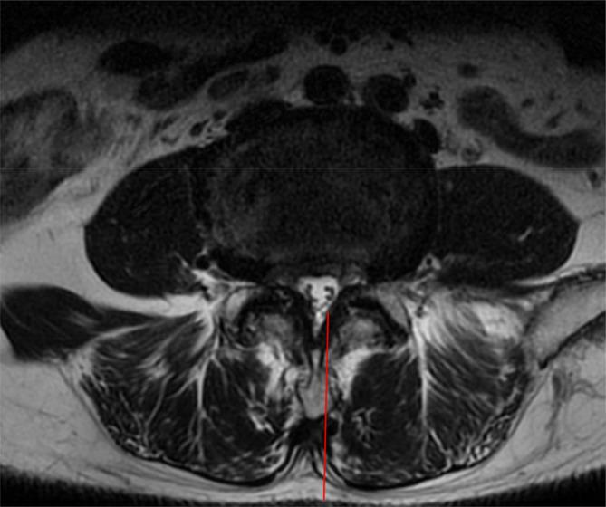 https://cdn.ncbi.nlm.nih.gov/pmc/blobs/76f9/10984805/c7a250691f2a/OS-16-842-g004.jpg