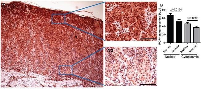 https://cdn.ncbi.nlm.nih.gov/pmc/blobs/76fa/5325362/1a18978225ba/oncotarget-07-63261-g012.jpg