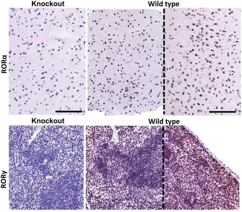 https://cdn.ncbi.nlm.nih.gov/pmc/blobs/76fa/5325362/3c3b052adeed/oncotarget-07-63261-g014.jpg