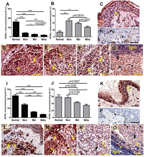 https://cdn.ncbi.nlm.nih.gov/pmc/blobs/76fa/5325362/c8e2d159025c/oncotarget-07-63261-g001.jpg