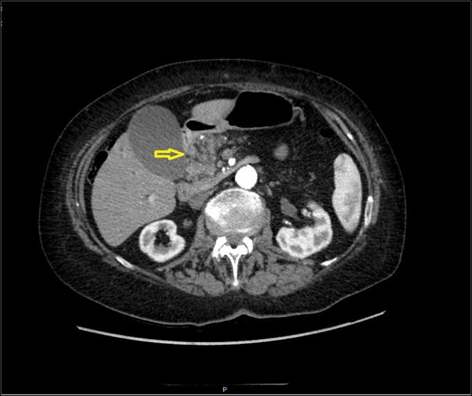 https://cdn.ncbi.nlm.nih.gov/pmc/blobs/76fd/8613338/d17107e882d8/ac9-8-e00704-g001.jpg