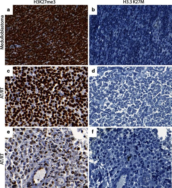 https://cdn.ncbi.nlm.nih.gov/pmc/blobs/7702/4201755/4c5bd1925fa5/401_2014_1338_Fig3_HTML.jpg