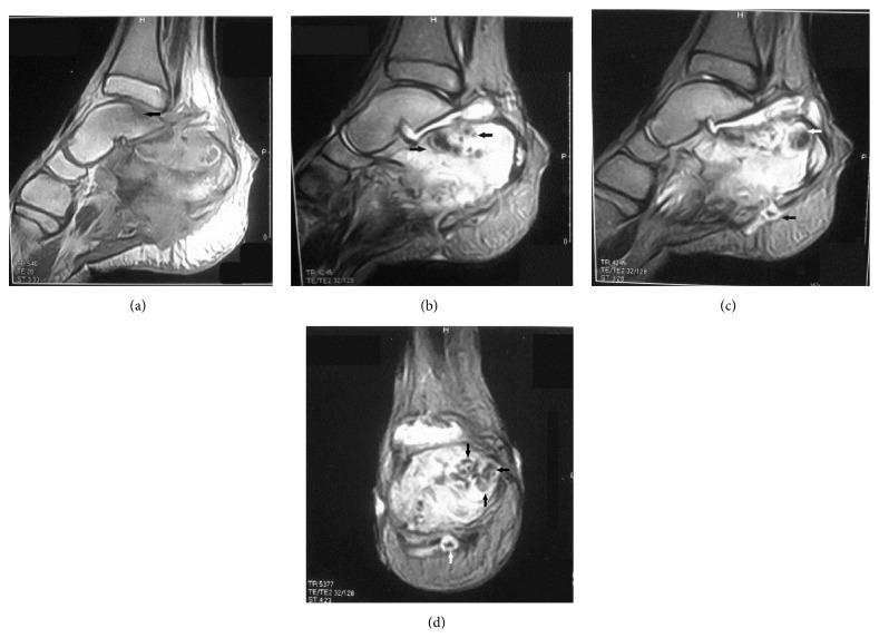 https://cdn.ncbi.nlm.nih.gov/pmc/blobs/7709/4592886/06b42bbaaf9a/CRIPA2015-129020.001.jpg