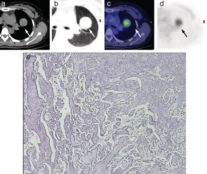 https://cdn.ncbi.nlm.nih.gov/pmc/blobs/770d/6610286/56064a5d3762/TCA-10-1552-g001.jpg
