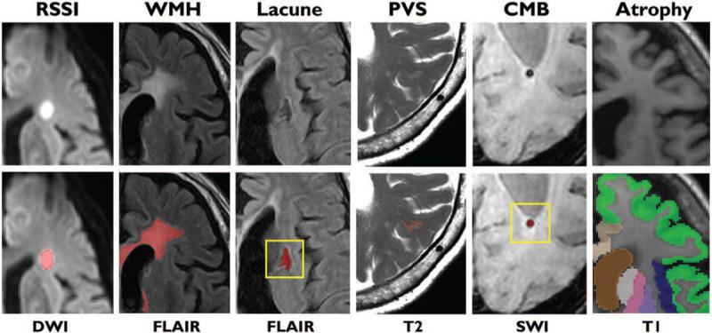https://cdn.ncbi.nlm.nih.gov/pmc/blobs/7711/7817342/fb130c6c66bb/cm9-134-151-g001.jpg