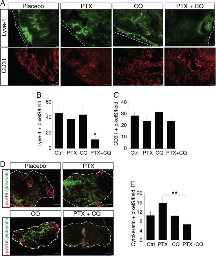 https://cdn.ncbi.nlm.nih.gov/pmc/blobs/7716/6925245/3a3c795919f6/41419_2019_2181_Fig7_HTML.jpg