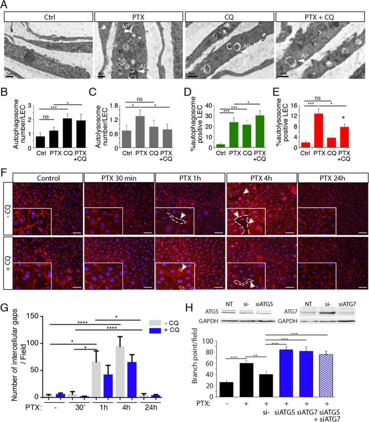 https://cdn.ncbi.nlm.nih.gov/pmc/blobs/7716/6925245/ec81b0c0ac49/41419_2019_2181_Fig4_HTML.jpg