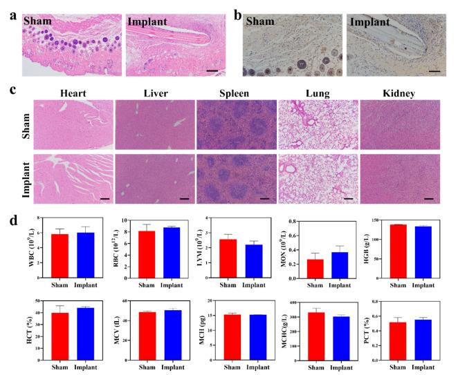 https://cdn.ncbi.nlm.nih.gov/pmc/blobs/7718/9555002/39e1c354a96f/12951_2022_1646_Fig4_HTML.jpg