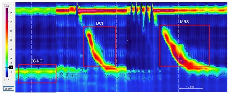 https://cdn.ncbi.nlm.nih.gov/pmc/blobs/7719/6031267/8d38c5ec9cec/gutjnl-2017-314722f02.jpg