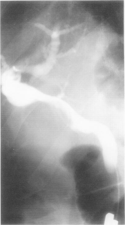 https://cdn.ncbi.nlm.nih.gov/pmc/blobs/771a/1027061/e9e833230247/gut00035-0128-a.jpg