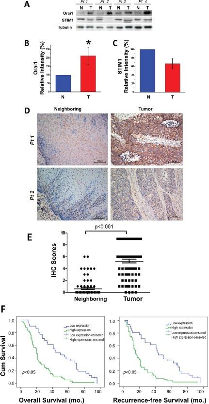 https://cdn.ncbi.nlm.nih.gov/pmc/blobs/772a/4116495/2cf12f84a5c0/oncotarget-05-3455-g001.jpg